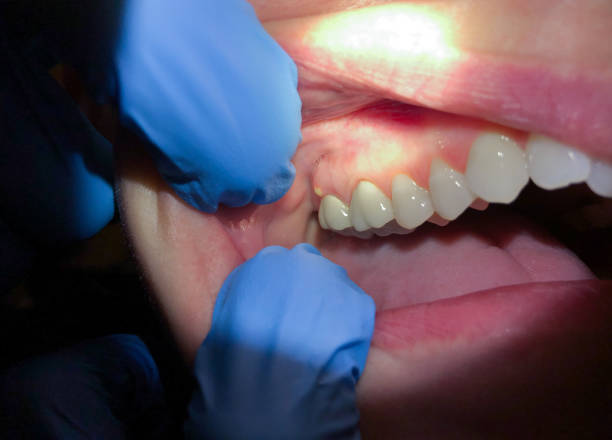 Best Mobile Emergency Dentist in The Village, OK